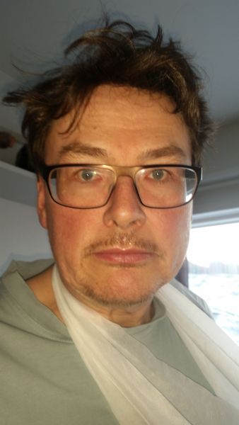 Dagen efter operation - med boksehandske