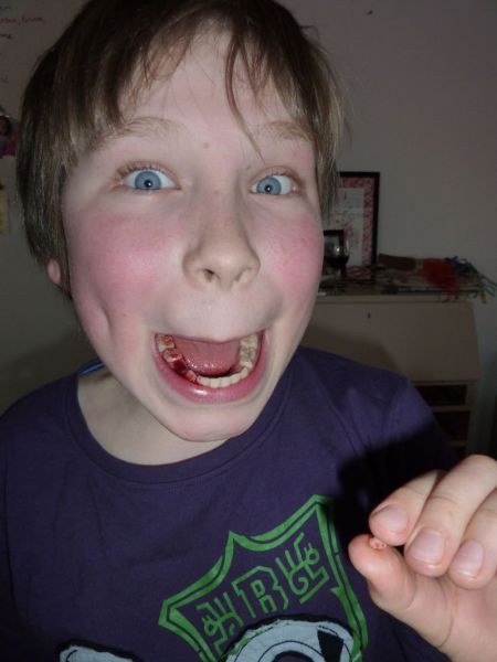 2011-04-20-1941_bedste_2