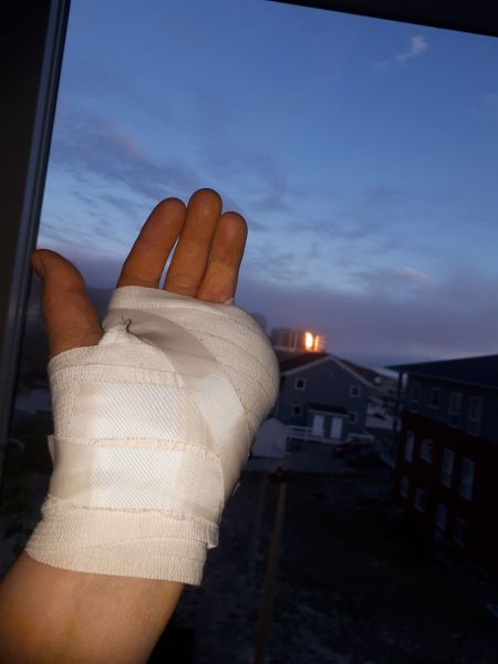 2020-07-03-2318_Operation_3