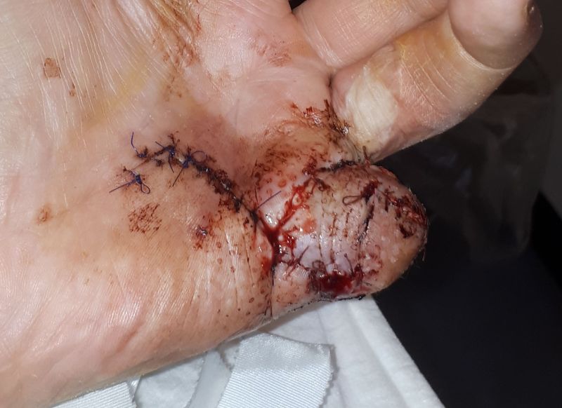 2020-07-06-1043_Operation_3