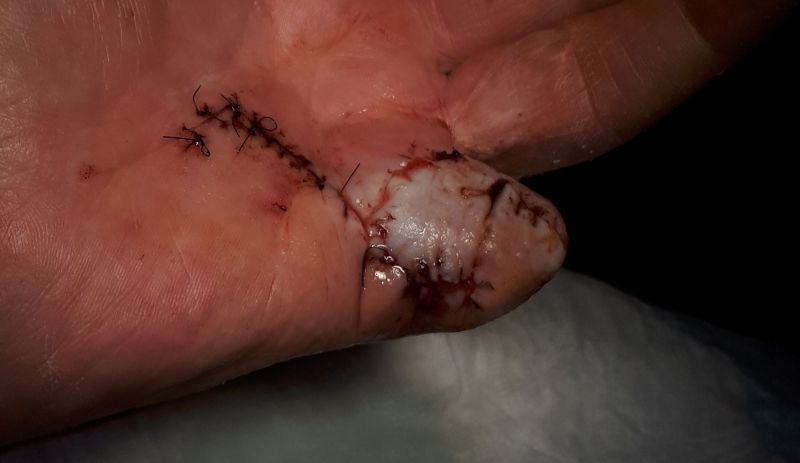 2020-07-08-1014_Operation_3