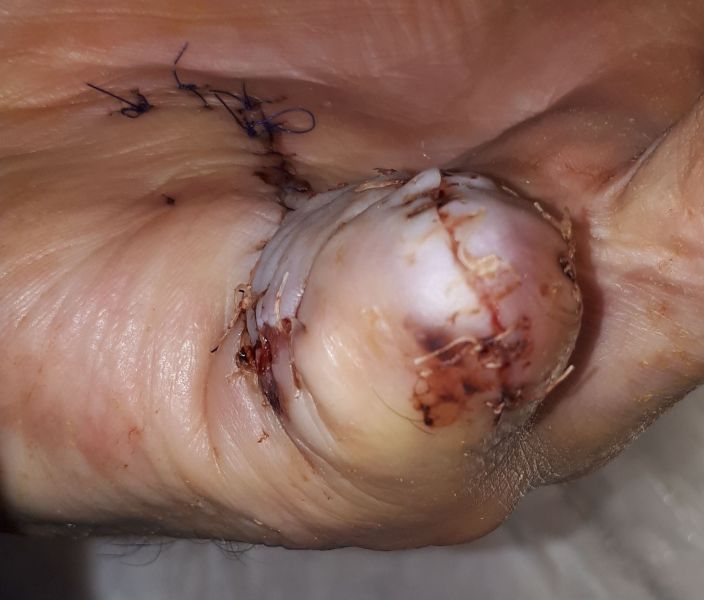 2020-07-08-1029_Operation_3