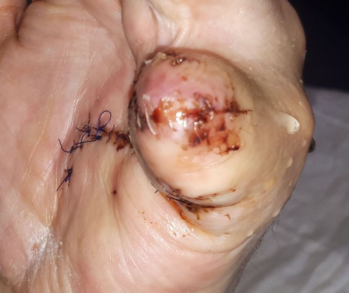 2020-07-10-1303_Operation_3