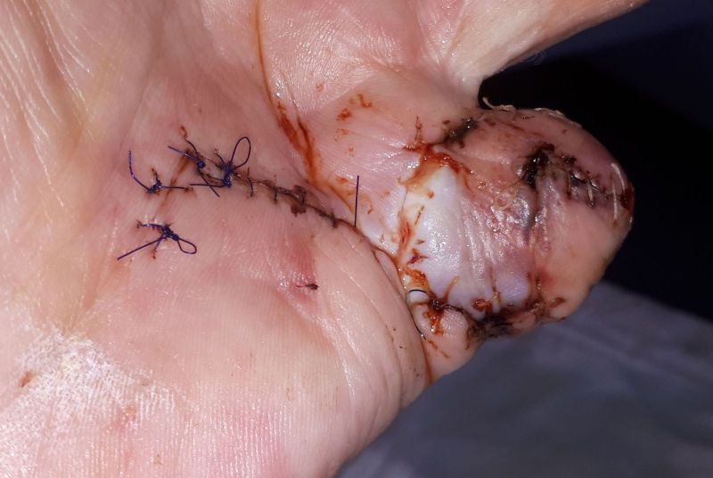 2020-07-10-1303_Operation_3_2