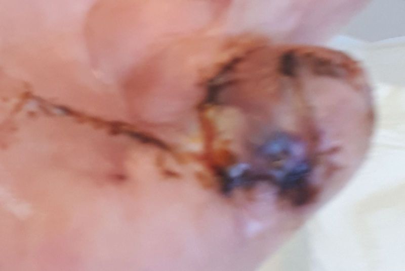 2020-07-14-1337_Operation_3