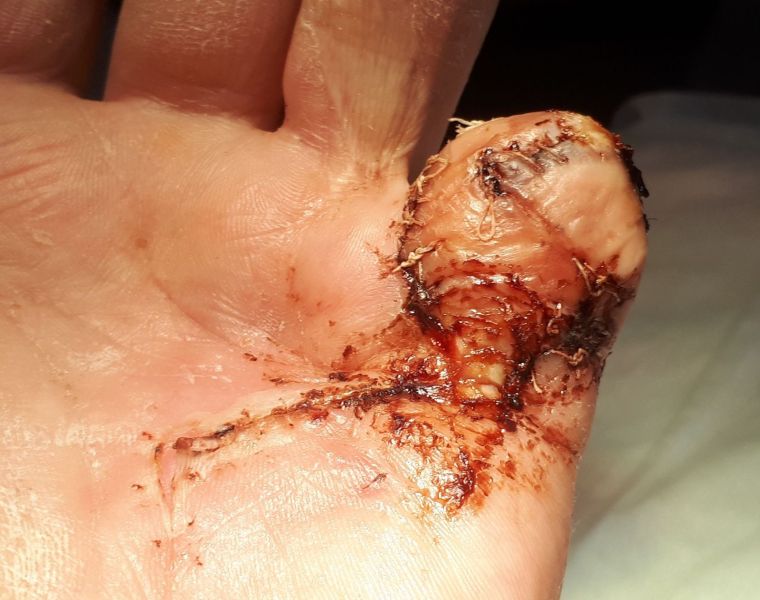 2020-07-17-1407_Operation_3