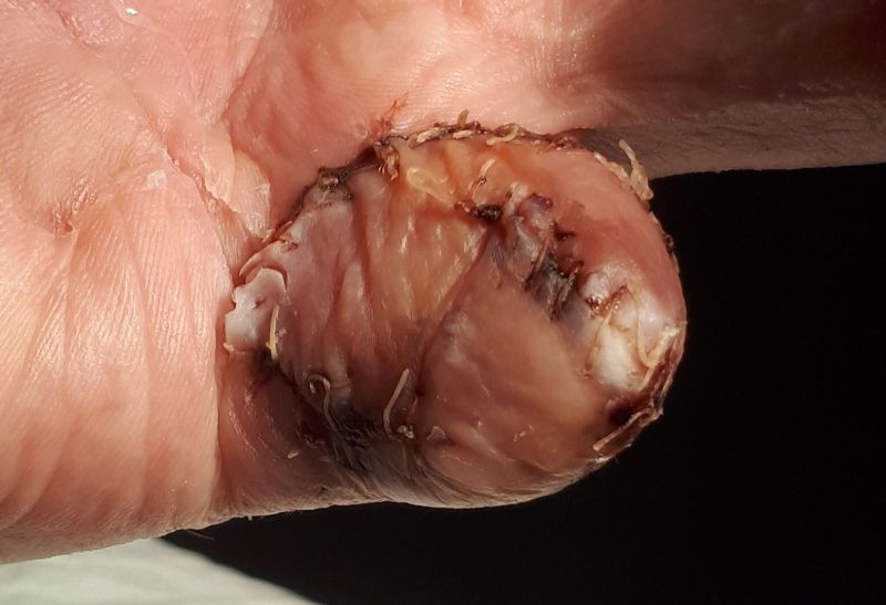 2020-07-17-1419_Operation_3