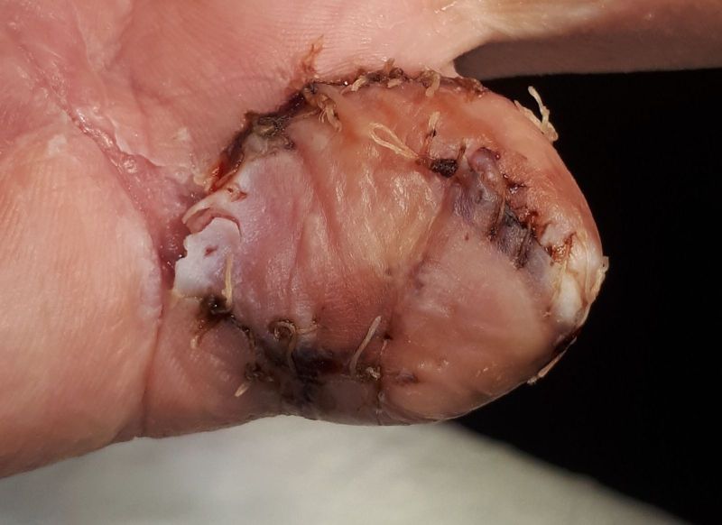 2020-07-17-1419_Operation_3_2