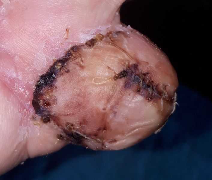 2020-07-27-1717_Operation_3