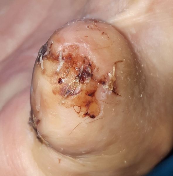 2020-07-27-1717_Operation_3_2