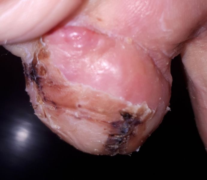 2020-08-03-2008_Operation_3