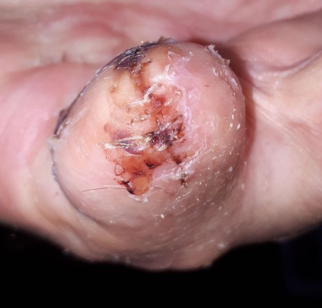 2020-08-03-2008_Operation_3_2