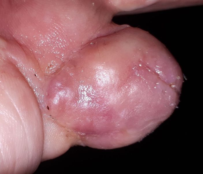 2020-08-07-1617_Operation_3