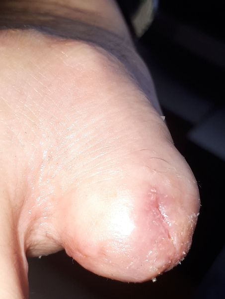 2020-08-07-1617_Operation_3_2