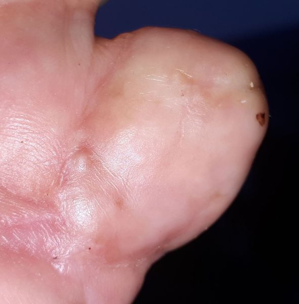 2020-08-27-0633_Operation_3