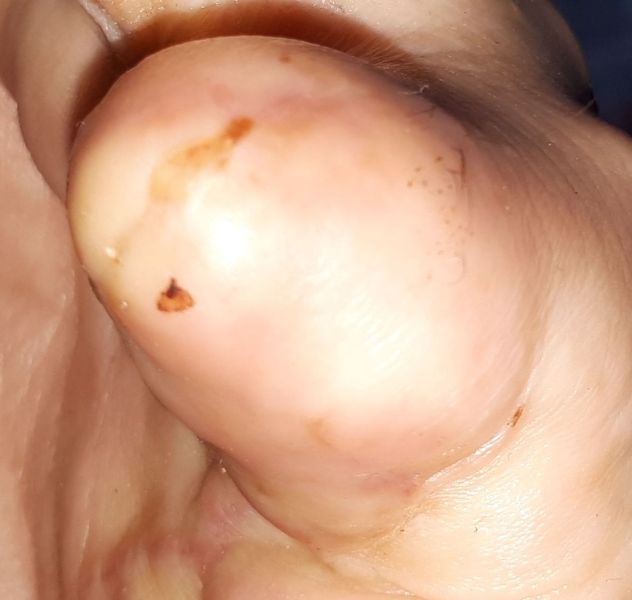 2020-08-27-0633_Operation_3_2