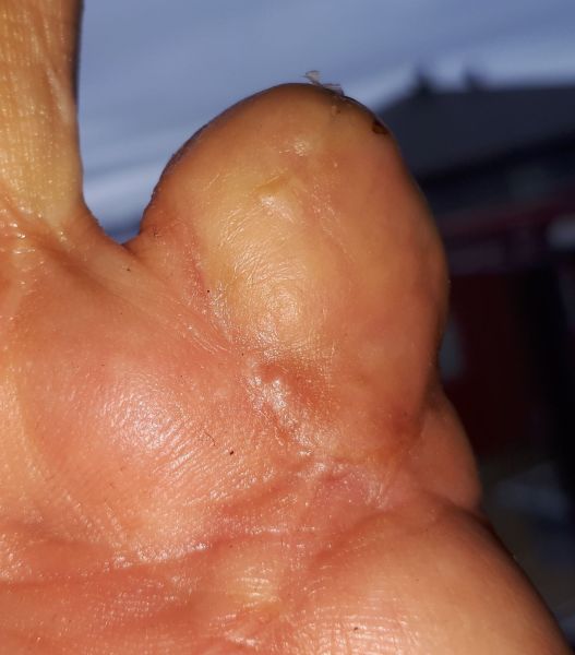 2020-09-06-1213_Operation_3