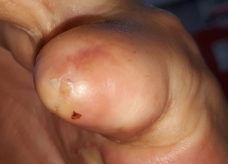 2020-09-06-1213_Operation_3_2